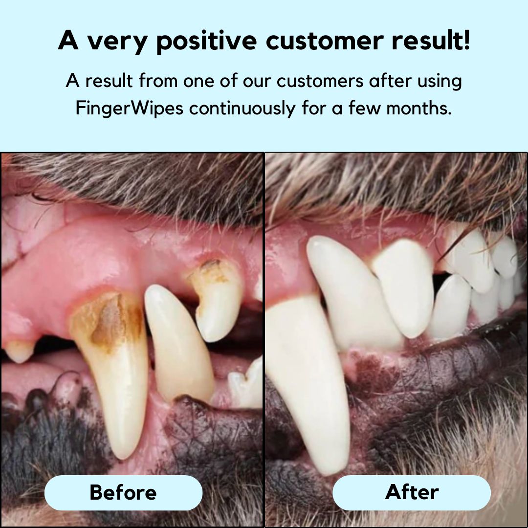 FreshWipes Kit – Protects Against Dental Diseases